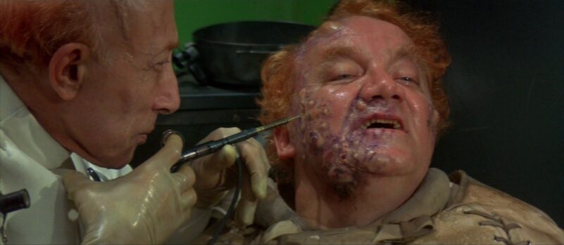 A doctor tends to boils on Baron Vladimir Harkonnen in Dune